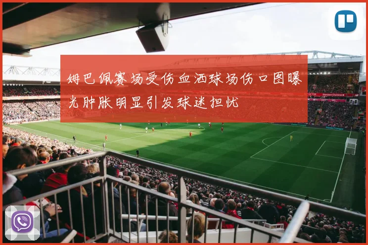 姆巴佩赛场受伤血洒球场伤口图曝光肿胀明显引发球迷担忧